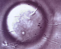 Sperm fertilizing an egg