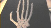 Skeletal hand...