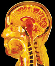 Sagital Slice of the Head