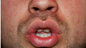 Charlie Swinbourne's mouth and nose