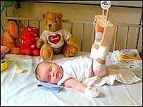 Baby in traction