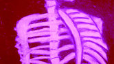 Chalk skeleton...