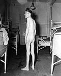 An emaciated survivor stands naked between rows of beds at the Hadamar Institute. © United States Holocaust Memorial Museum (USHMM)