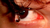 Eye drop