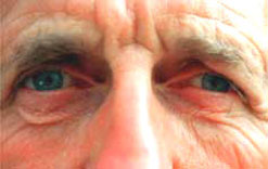A close-up of an elderly man's eyes