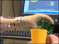 artificial limb