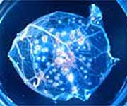 Smallpox virus cell