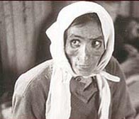 Photograph showing a woman in the hut where Typhus sufferers were housed