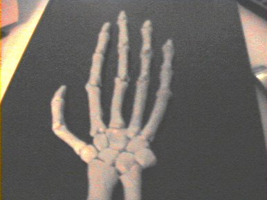 Skeletal hand model