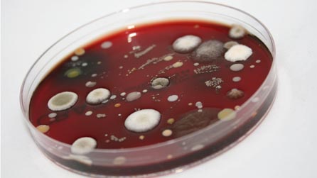 petri dish .jpg