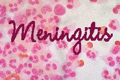 Meningitis