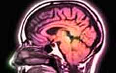 Brain Scan