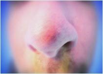 Nose