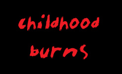 Childhood burns
