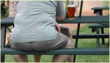 obese drinker