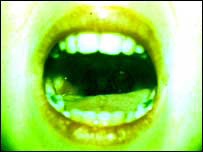 open mouth