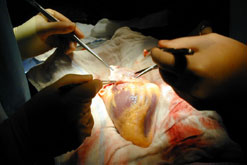 A human heart between donor and recipient. Taken by the heart surgeon, Francis Wells.