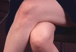 A young woman's bare knees