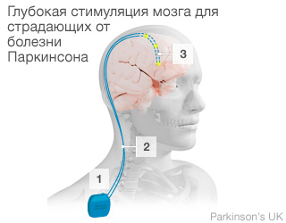 Brain infographic